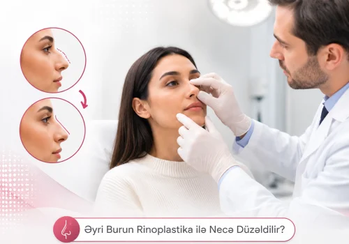 Eyri Burun Rinoplastika ile Nece Duzeldilir?