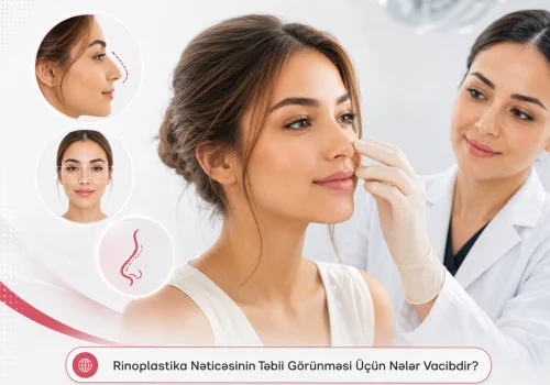 Rinoplastika Neticesinin Tebii Gorunmesi Ucun Neler Vacibdir?